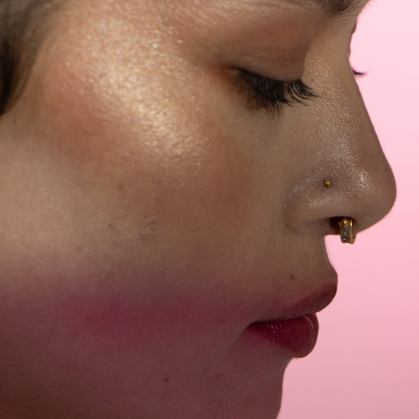 Sideburns Laser Hair Removal